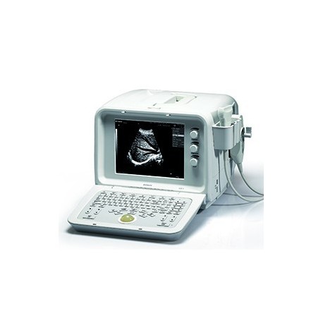 ECÓGRAFO PORTÁTIL DIGITAL 2.5MHz a 10MHz. PANTALLA 10”. SONDA CONVEXA