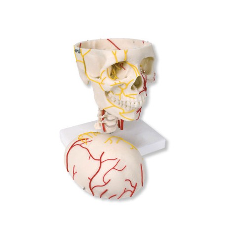 Cráneo neurovascular (W19018)