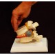 Simulador vertebral con hernia discal. (VER-00001)