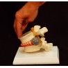 Simulador vertebral con hernia discal. (VER-00001)