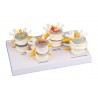Tipos de discos vertebrales (ER-7576)