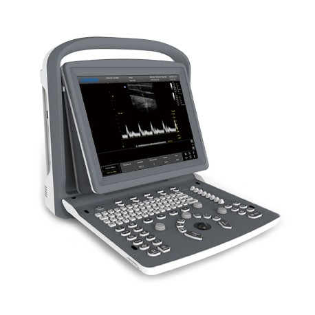 Ecógrafo Chison ECO 1 con sonda incluida pantalla 12 pulgadas, blanco y negro