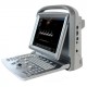 Ecógrafo Chison ECO 1 con sonda incluida pantalla 12 pulgadas, blanco y negro